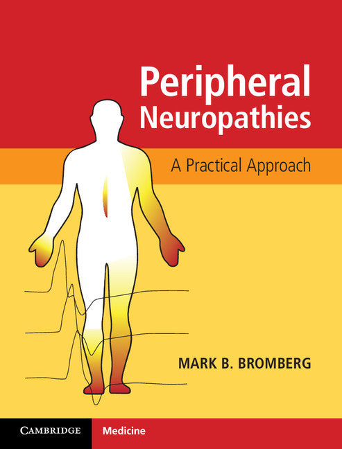 SALE Peripheral Neuropathies